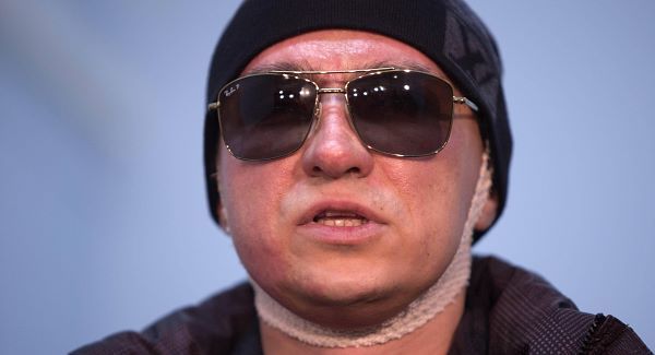 Sergei Filin, speaks with the media as he leaves a hospital in Moscow after the attack.